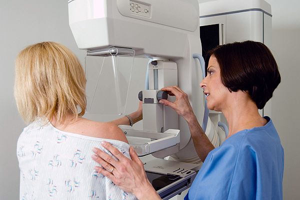 mamografias preventivas